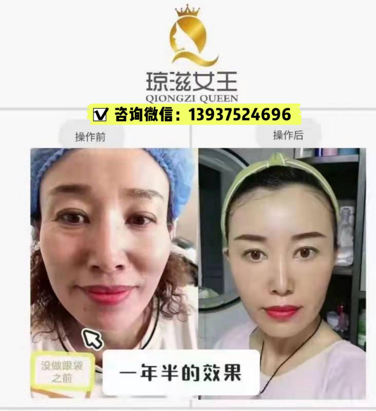 琼滋女王御肤焕颜套真的管用吗怎么加盟