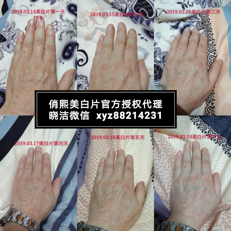 俏熙美白片零售 代理加盟 官方通道 It搜购网