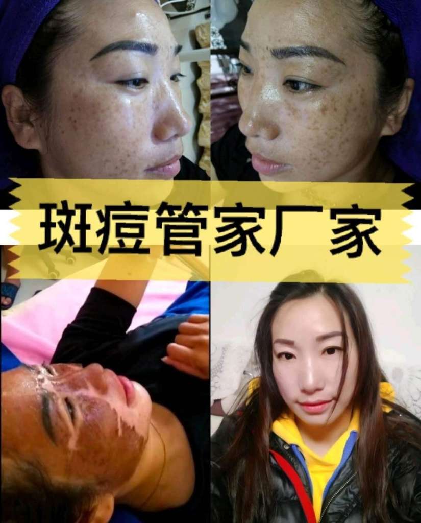 C:\Users\ADMINI~1.8Q2\AppData\Local\Temp\WeChat Files\7b95a4858f569e384996cf767c15a68.jpg