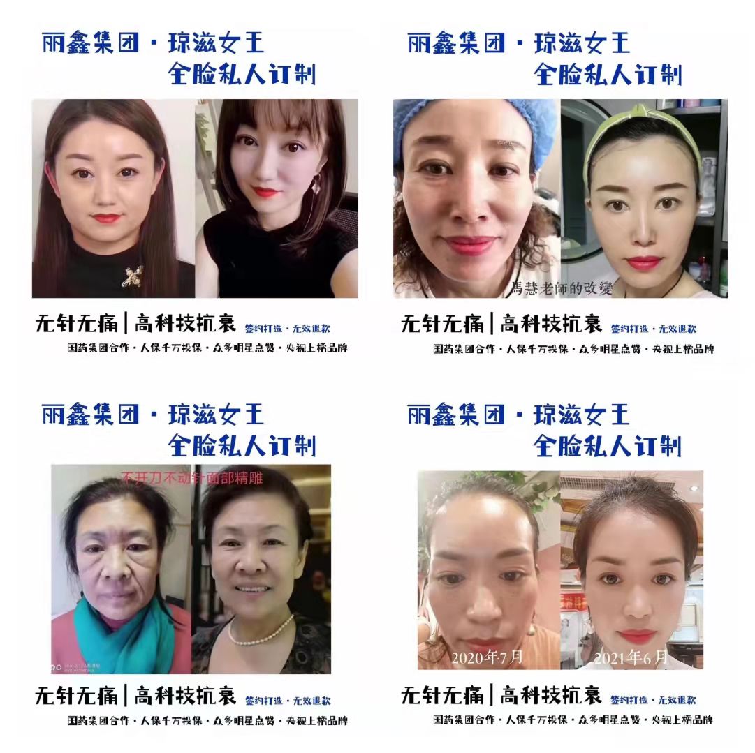 莱美姿琼滋女王去皱多少钱一盒会不会没效果