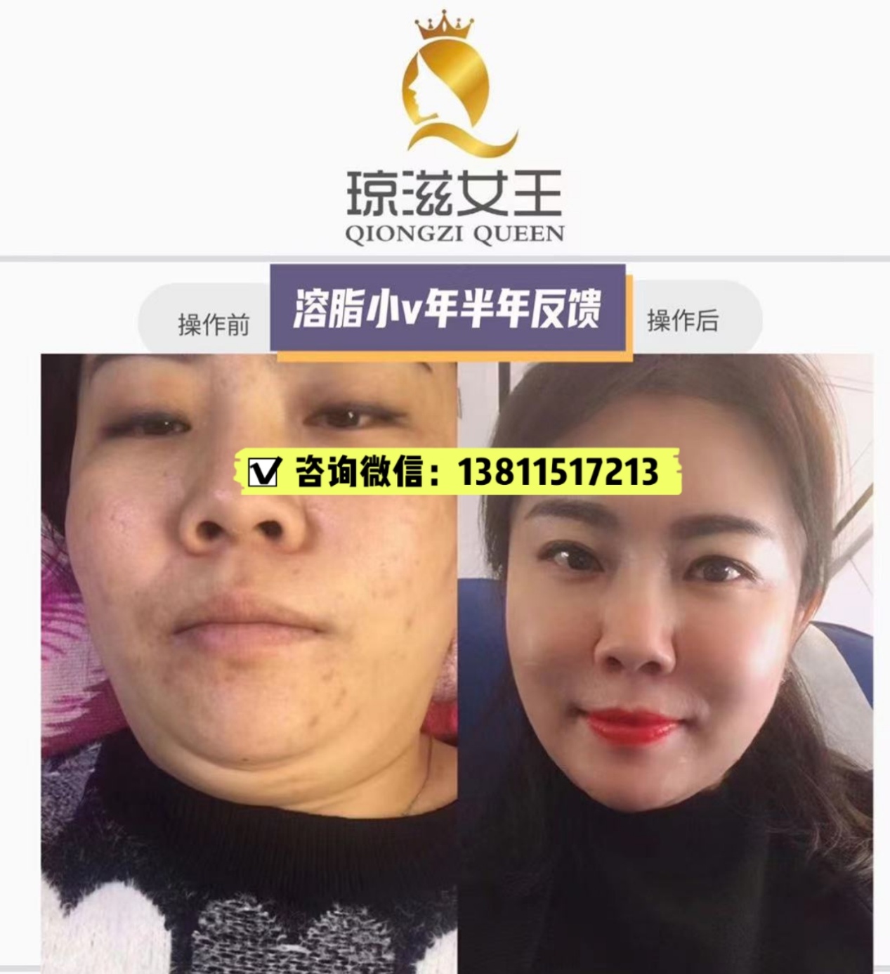 莱美姿琼姿女王加盟有门槛吗?月收入有多少?